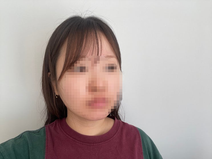  [구의동피부관리] 피지부터 탄력까지! 구의리프팅은 블랑 드 제이 에스테틱에서