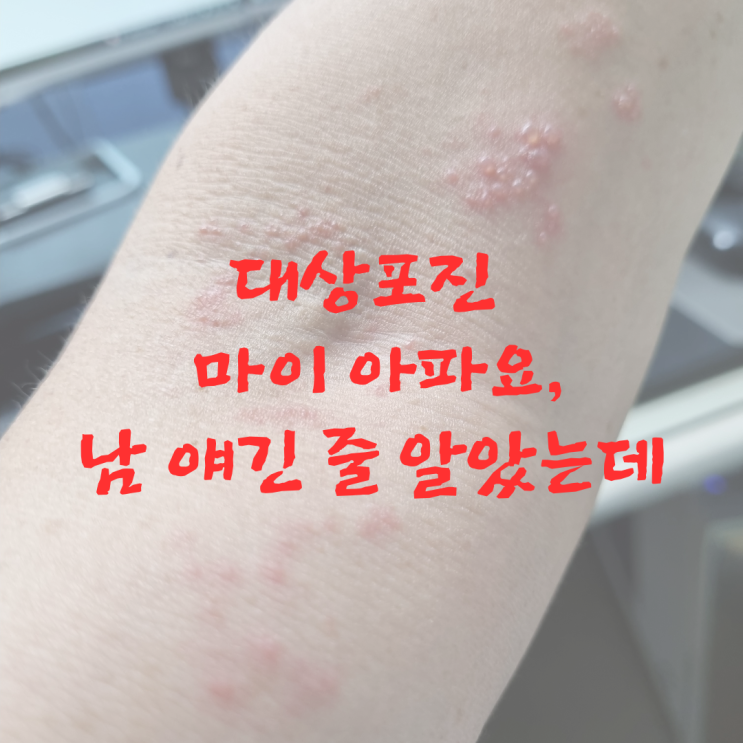  대상포진 마이 아파요, 남 얘긴 줄 알았는데