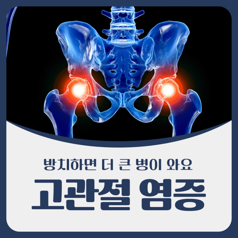 고관절염증 방치하면 더 큰 병을 불러와요
