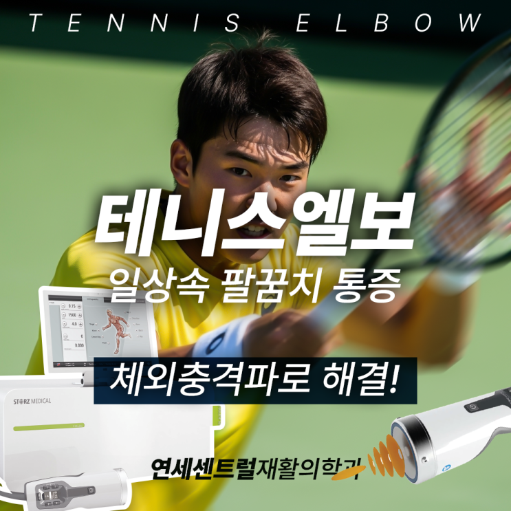  을지로테니스엘보, 일상 속 통증 체외충격파 치료로 해결