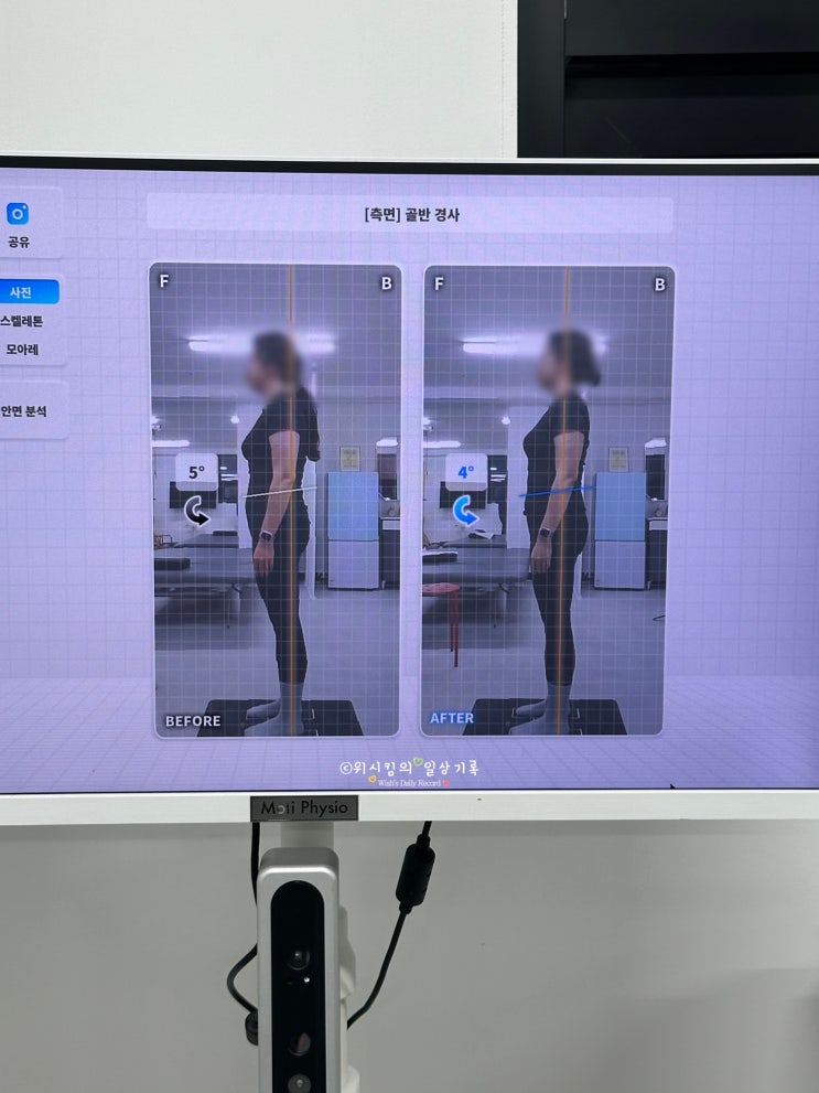  마포필라테스 다앤유재활운동센터 1회 효과