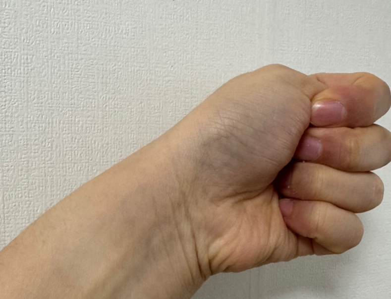 손목건초염 테이핑 하는 법 통증 완화 방법 꿀팁 공유