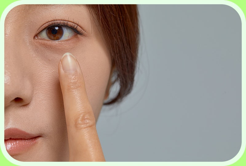 천안한관종 눈가에 생겼다면? (다양한 질환과 비교)