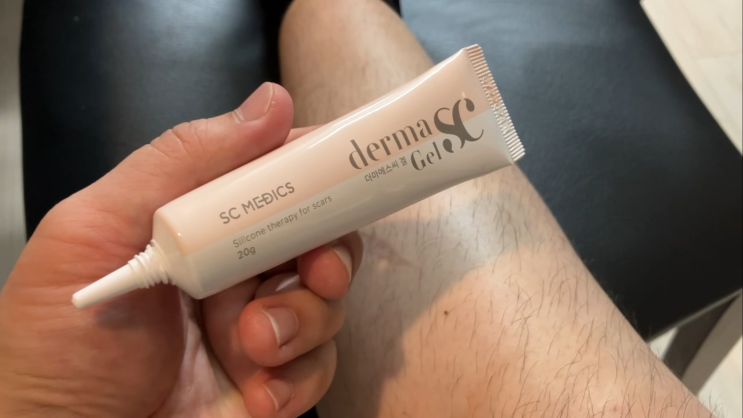  흉터 색소침착 연고 더마에스씨겔, 제왕절개 흉터 관리를 위한 선택