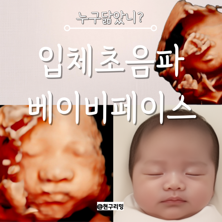  임신 29주차 토리 입체초음파 성공 베이비페이스 공개