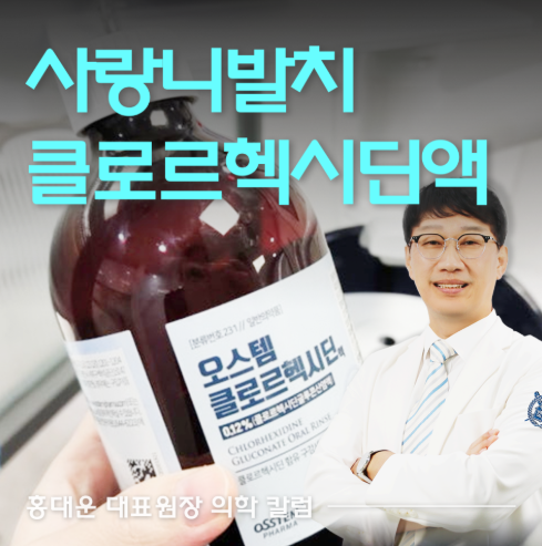오스템 클로르헥시딘 사용법, 사랑니 발치 후 가글