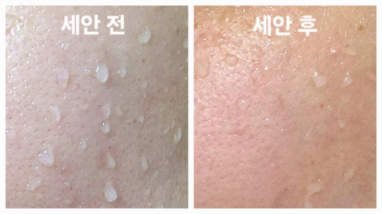  올바른 선크림 세안법 썬크림 안지우고 자면 생기는 일