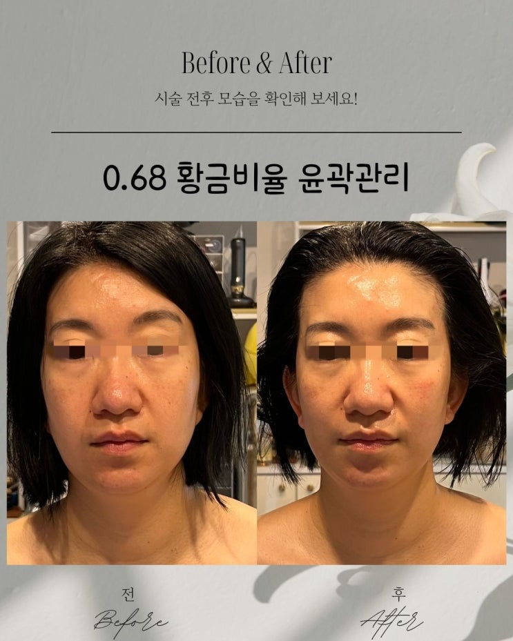  황금비율 0.68안면인대 유지를 돕는 윤곽관리  동래피부관리