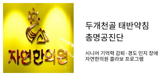   기억력 감퇴와 경도 인지장애, 미리미리 관리하세요