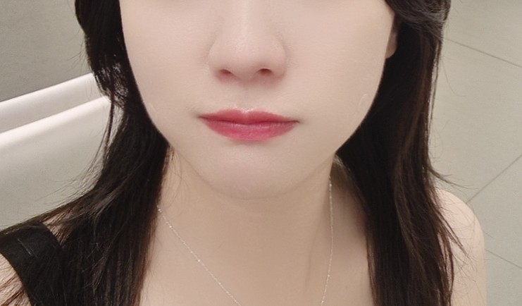  수지구청 콜라겐주사 콜라레쥬 효과 후기