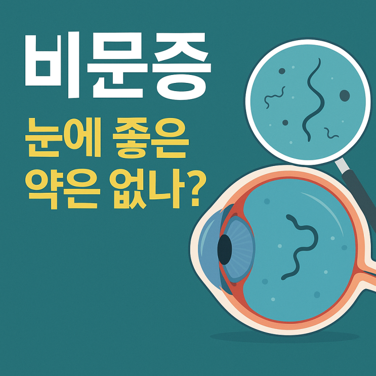  “비문증이란? 눈앞에 날파리가 보일 때, 치료 전 꼭 알아야 할 5가지”
