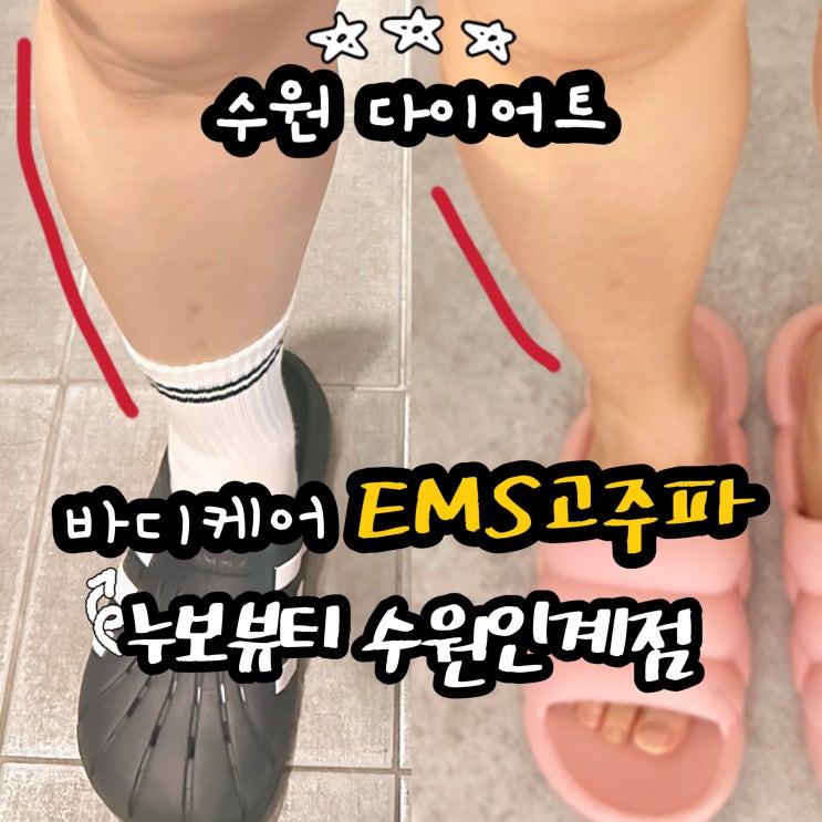  수원다이어트 누보뷰티 인계점 종아리케어 후기