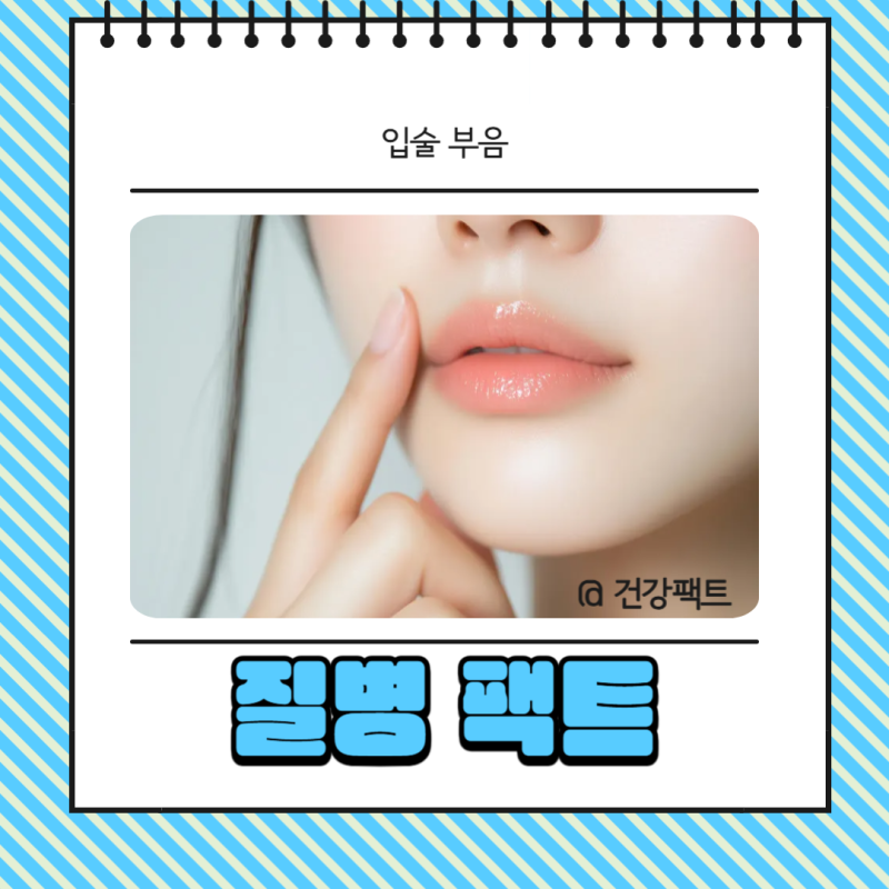 갑자기 윗입술 아래 입술 부음 원인과 병원 치료 약 정보