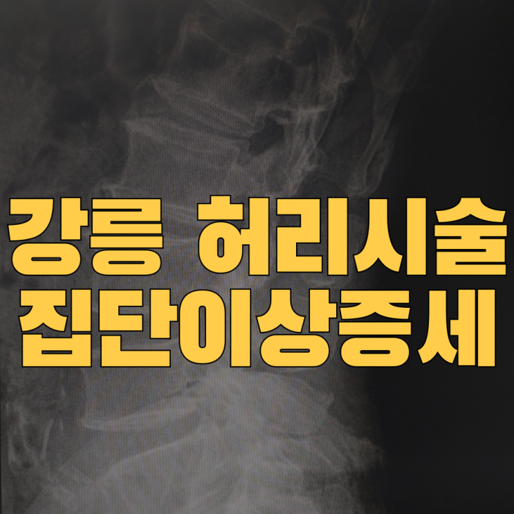  강릉 허리시술 후 1명 사망·7명 이상증상…현직 의사가 본 문제점은