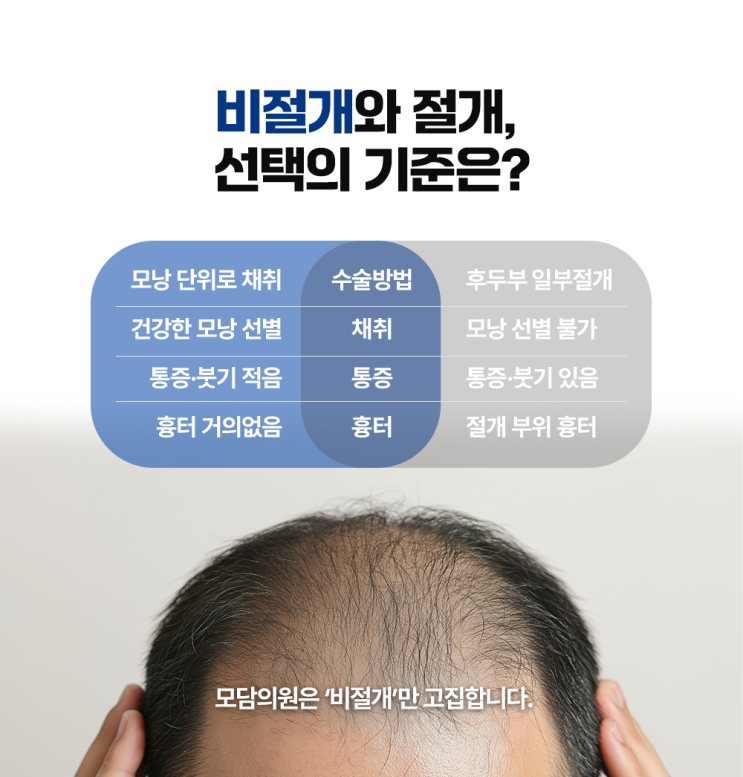  창원모발이식병원 절개 vs 비절개 나에게 맞는 방식은?