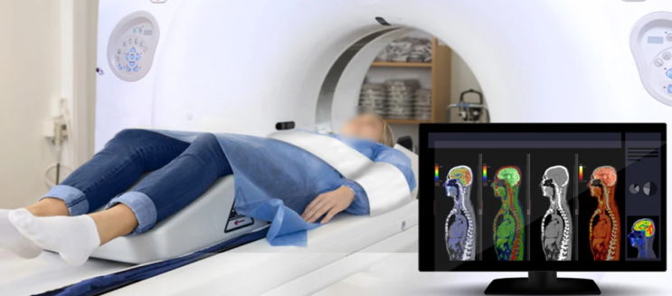  펫시티 전신 PET CT 검사 시간 비용 목적 금식 부작용 방사능 피폭 주의사항