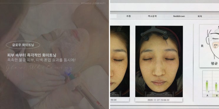  삐땅기린뷰티 센터, 전문 의료진의 체형관리 서비스를 경험하다