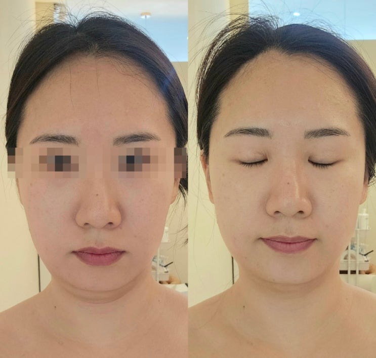  경산하양신부관리 마사지 추천 에프앤비샵 프리미엄 에스테틱 경산하양점