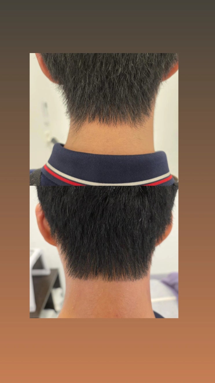  영등포역 남자 왁싱샵 "청춘케어" 남자 네이프 라인 왁싱