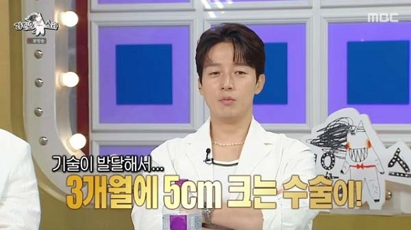 <b>허경환</b>, 167cm 한 맺힌 <b>키</b>... 사지 연장술 상담 (‘<b>미우새</b>’)