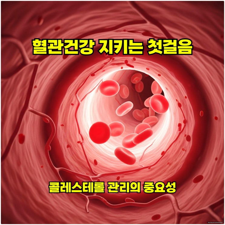  혈관 건강 지키는 첫걸음: 콜레스테롤 관리의 중요성