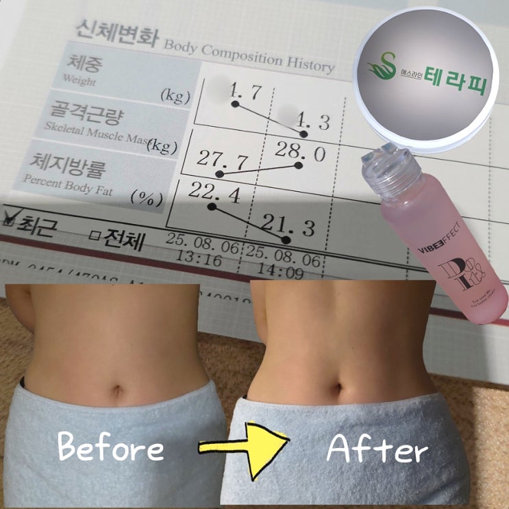  대구동구 봉무동 누워서살빼기 체질개선다이어트 전문 에스라인테라피 셀포랩아우름점 찐찐후기