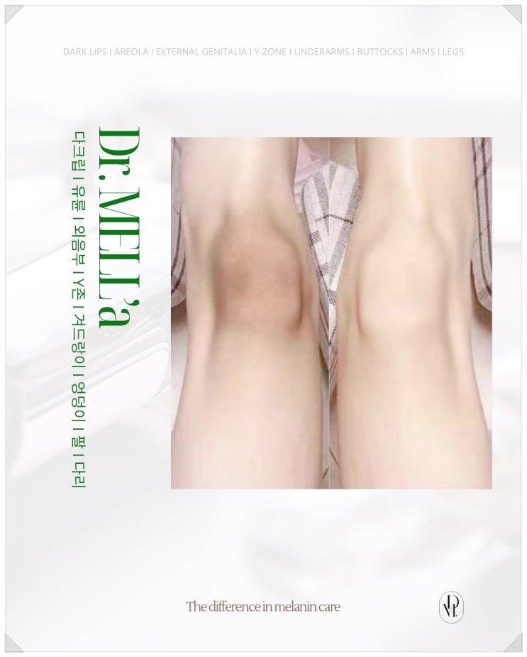  멜라닌케어 가격, 닥터멜라에서 확인하는 합리적인 비용과 효과