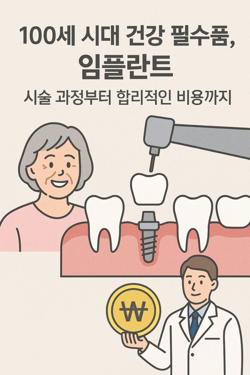100세 시대 건강 필수품, 임플란트: 시술 과정부터 합리적인 비용까지