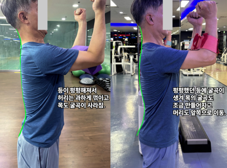  목디스크, 허리가 원인이라고?(우만동pt)