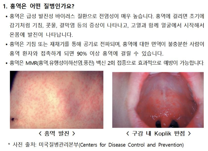   국내 홍역 환자 68명 발생…해외유입 72%