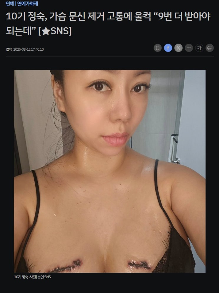나는 솔로 10기 정숙, 문신 제거 근황 …과거 사건 딛고 새출발 진심