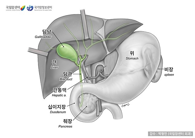 산악인 허영호도 넘지 못한 담도암…"조용하지만 치명적"