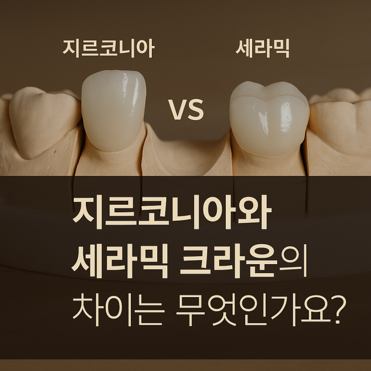   지르코니아 vs 세라믹 크라운 — 어떤 차이가 있을까요?