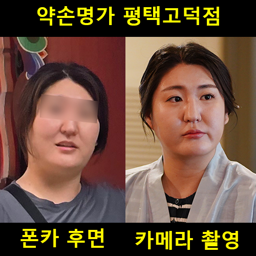  평택 에스테틱 추천, 약손명가 평택고덕점 맞춤관리A, 이중턱 웨딩준비