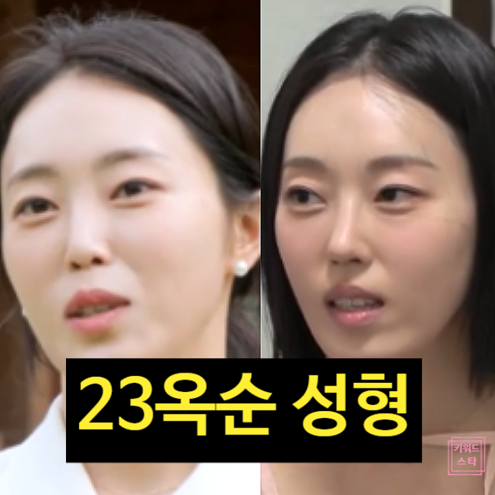  나솔사계 23기 옥순 추가 성형 고백!? 순자 함께 병원행 사연!