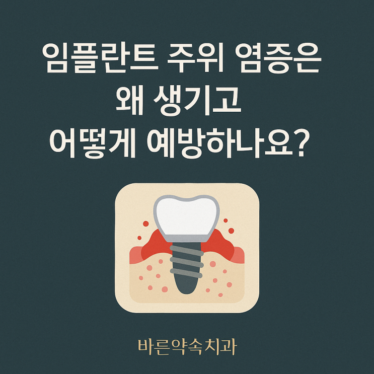   임플란트 주위 염증은 왜 생기고 어떻게 예방하나요?