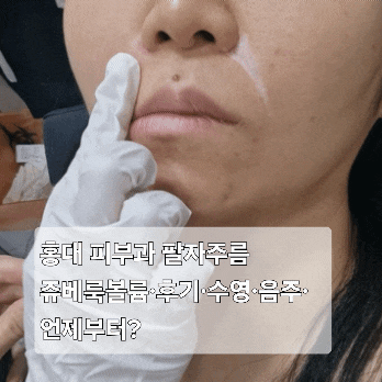  홍대 피부과 팔자주름 쥬베룩볼륨·후기·수영·음주·언제부터?