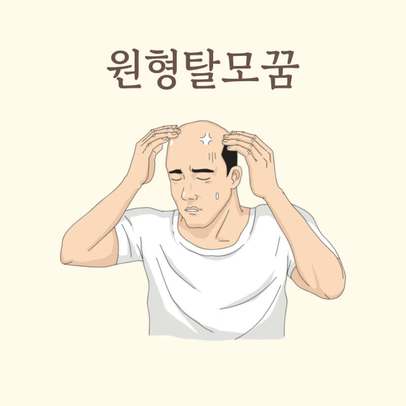 원형탈모 꿈 해몽 알아보기