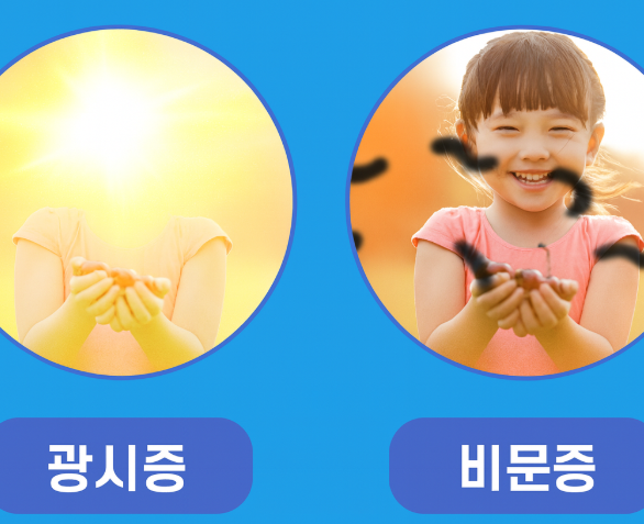  비문증 증상 원인 치료 광시증 차이는?