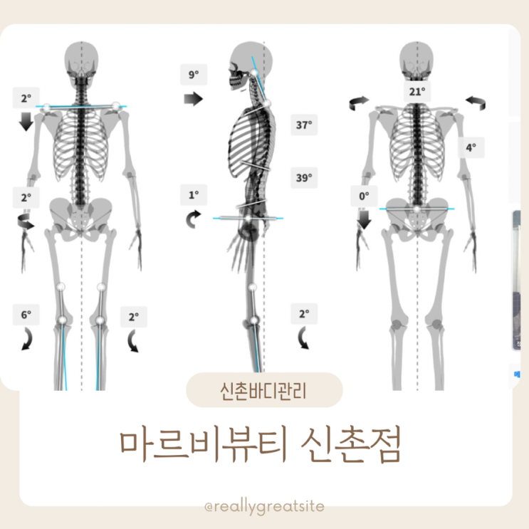 신촌 다이어트 ㅣ 마르비 뷰티 ㅣ 신촌 바디관리 슬리밍 관리 후기 ㅣ신촌신부관리