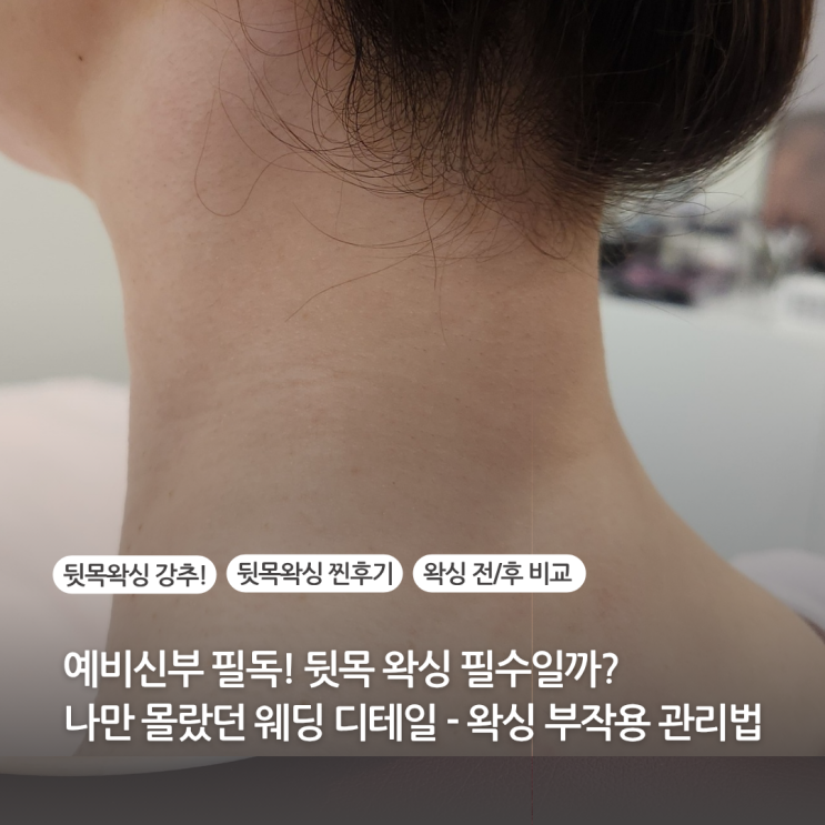  뒷목왁싱 후기 가격 주기 왁싱후관리법 왁싱부작용 나만 몰랐던 웨딩 디테일 챙기는 방법