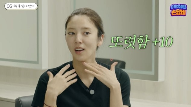 손담비 출산 후 달라진 얼굴 라인 회복 도전! 리프팅 시술 최초 공개