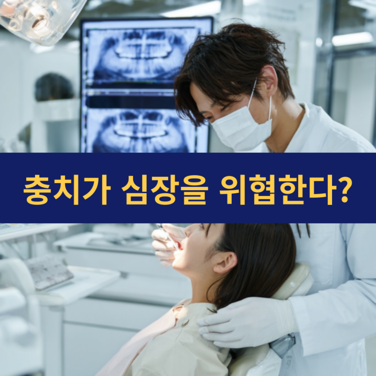  충치가 심장을 위협한다? 구강 건강이 심혈관 질환의 원인일 수 있다.