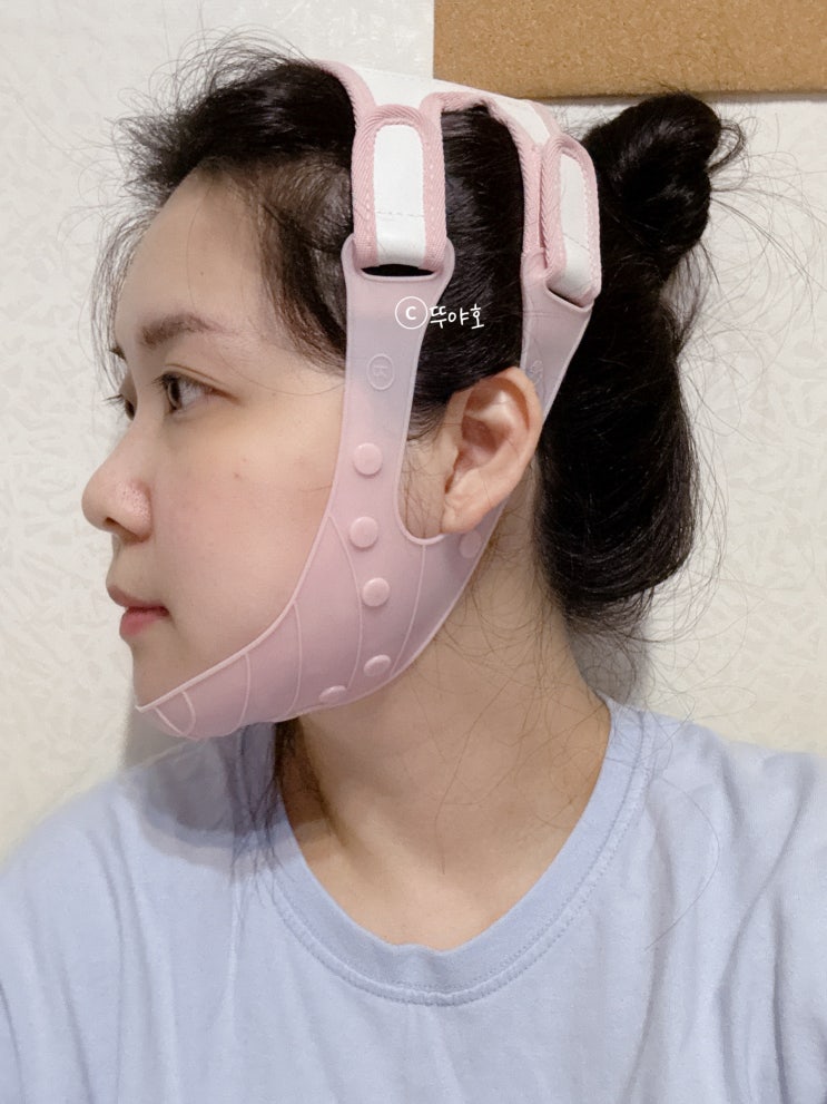  브이라인 관리 약손명가 리프팅밴드 리뉴얼 버전 찐 후기