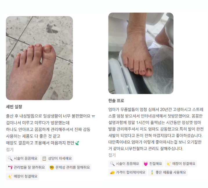 전주무좀발톱, 안 낫는 이유? 지금 당장 '이것' 부터 하세요!