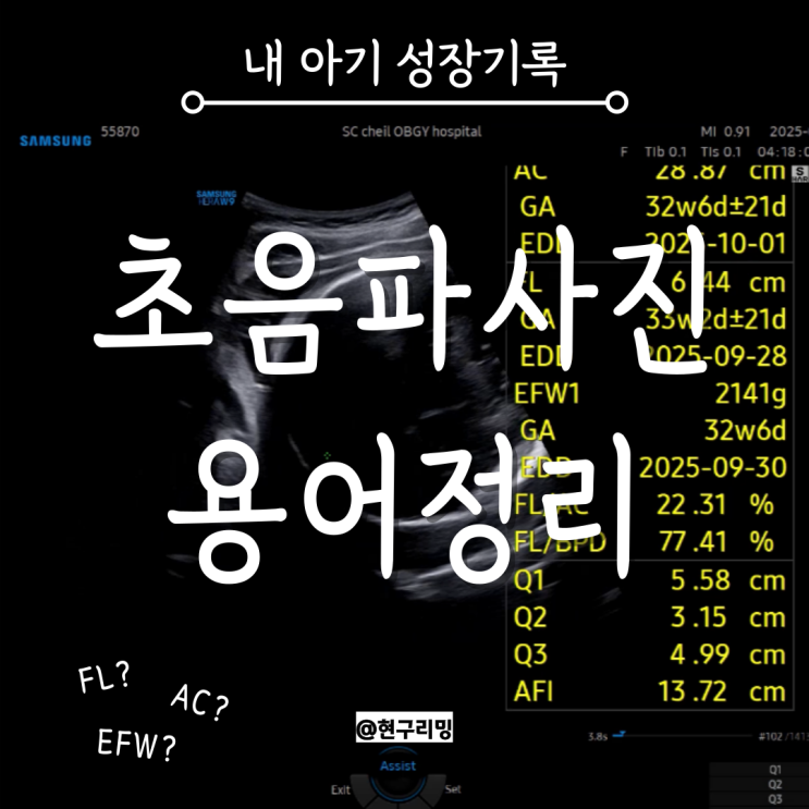  임신 초기 중기 별 태아 초음파사진 용어 정리 및 열달후에 성장기록 보는법