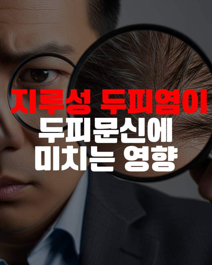  지긋지긋한 두피 가려움과 비듬, '지루성 두피염'이 두피문신에 미치는 영향은?