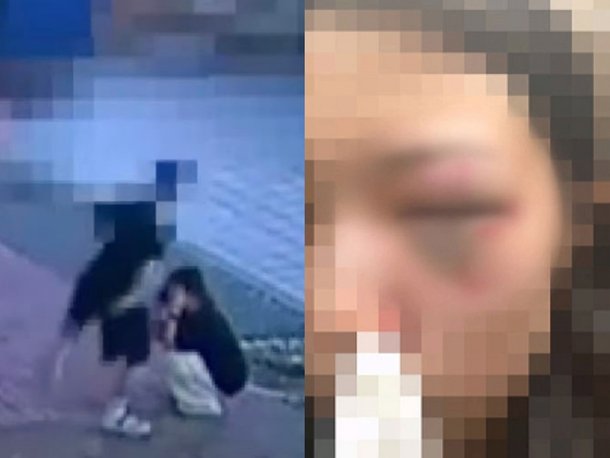  태권도 선수, 여자친구 폭행! 안와골절까지 남긴 충격 사건