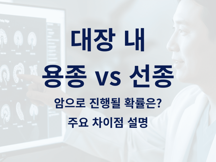  대장 내 용종 vs 선종, 언제 암으로 진행될까? 주요 차이점 설명