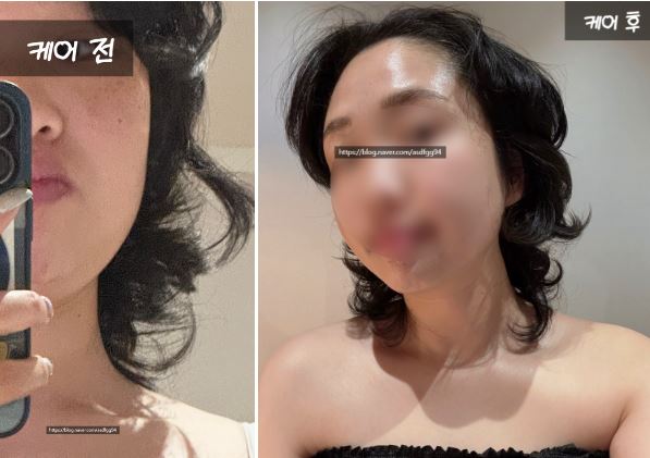  인천 계양 피부관리실 추천 탐날에스테틱 방문기